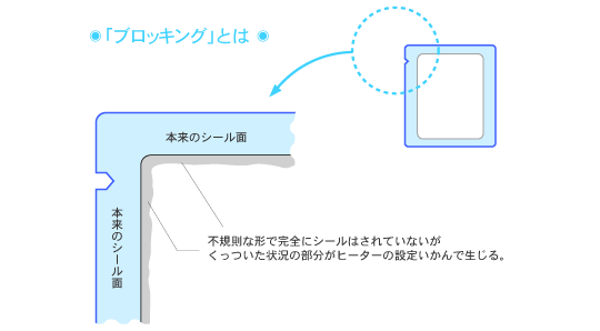 「ブロッキング」とは